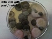 fungus